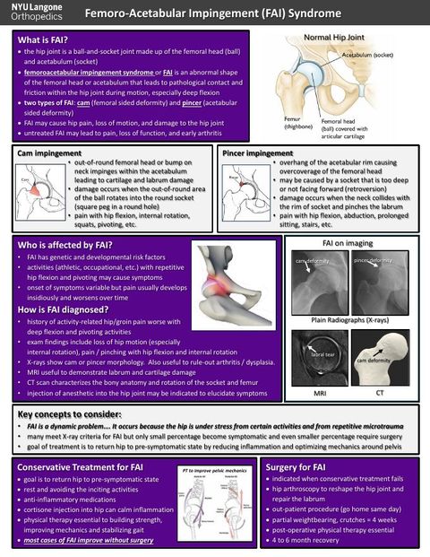 Preview of the Femoro-Acetabular Impingement (FAI) Syndrome handout