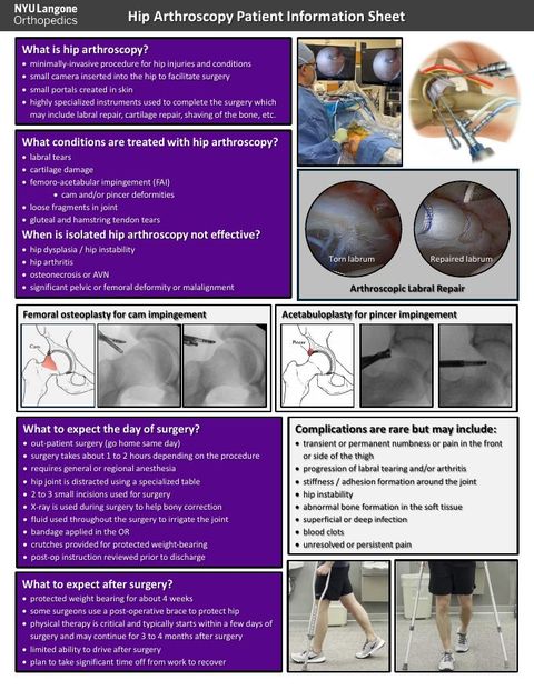 Preview of the Hip Arthroscopy Patient Information Sheet